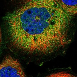 FAM126A Antibody, Novus Biologicals:Antibodies:Primary Antibodies